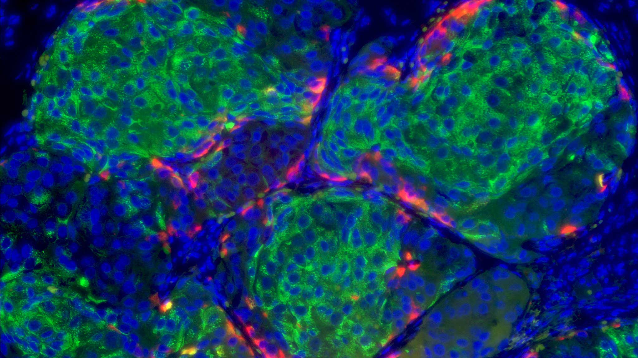 stem-cell-derived-beta-cell.jpg