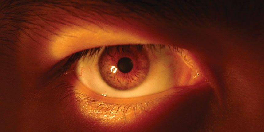 diabéteszes retinopátia